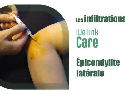 Infiltration épicondylite latérale ou tennis elbow (Dr Kevin Boulanger)