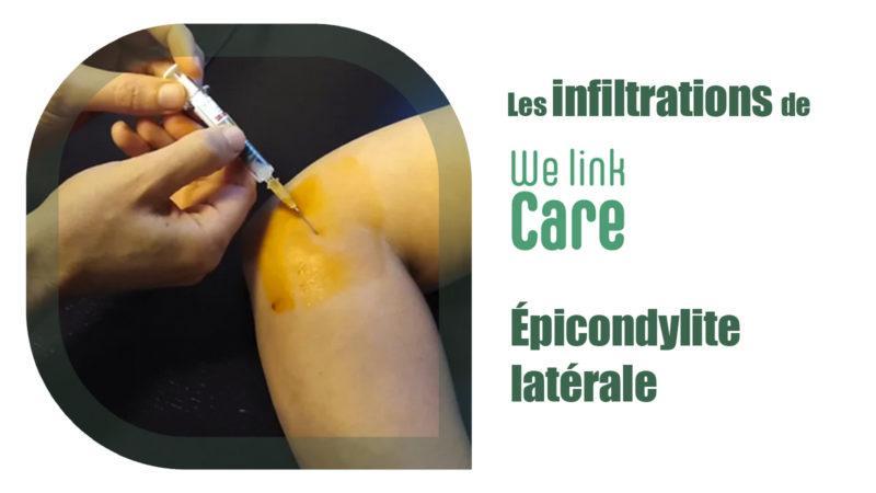 Infiltration épicondylite latérale ou tennis elbow (Dr Kevin Boulanger)