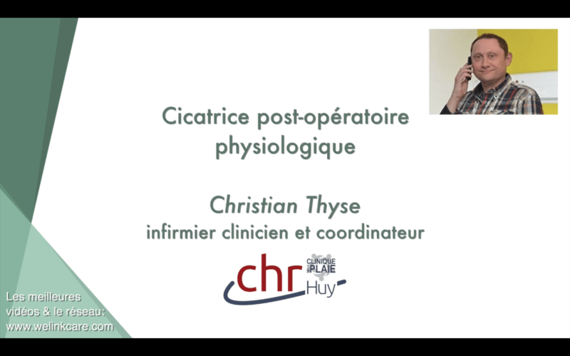 Cicatrice post-opératoire physiologique (Christian Thyse)