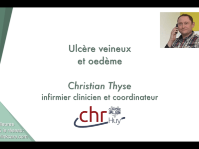Ulcère veineux et oedème (Christian Thyse)