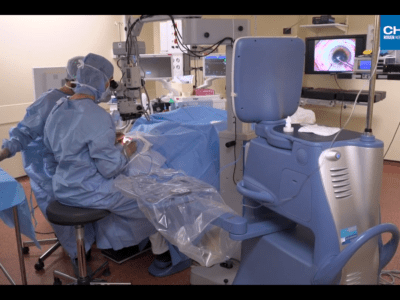 Cataracte : la chirurgie au laser