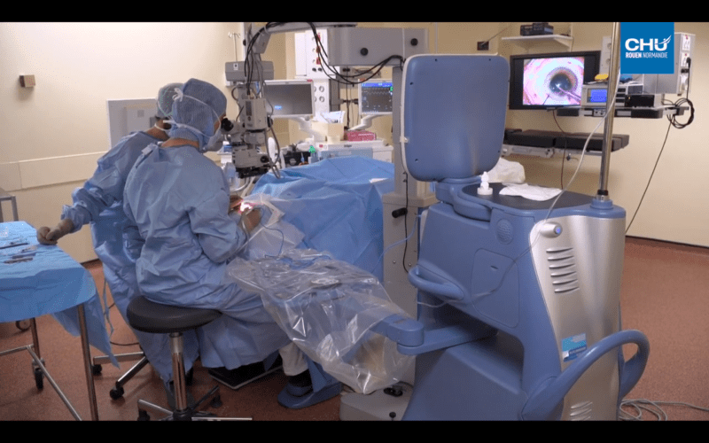 Cataracte : la chirurgie au laser