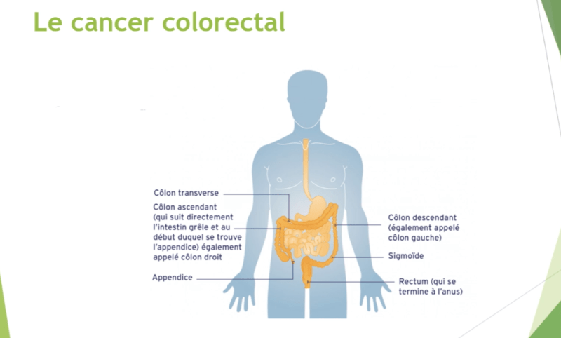 Dépistage du cancer colorectal (Justin Joris)