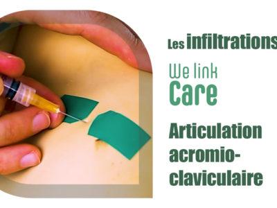 Infiltration - articulation acromio-claviculaire (Dr Kevin Boulanger)