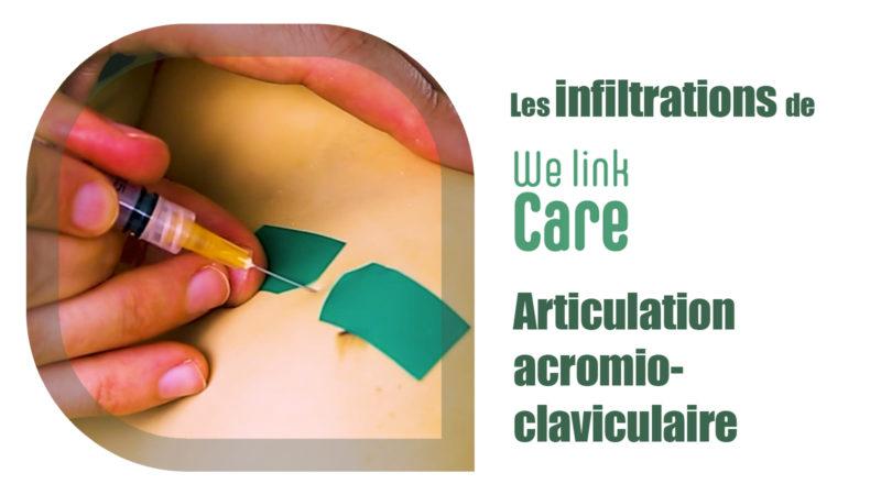 Infiltration - articulation acromio-claviculaire (Dr Kevin Boulanger)
