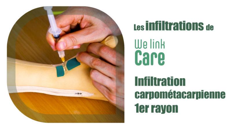 Infiltration carpométacarpienne 1er rayon (Dr Kevin Boulanger)