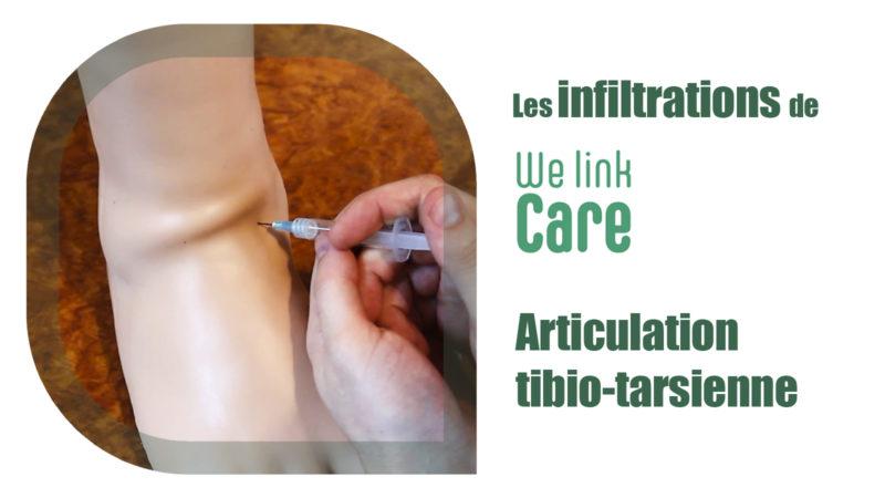 Infiltration - articulation tibio-tarsienne (Dr Kevin Boulanger)