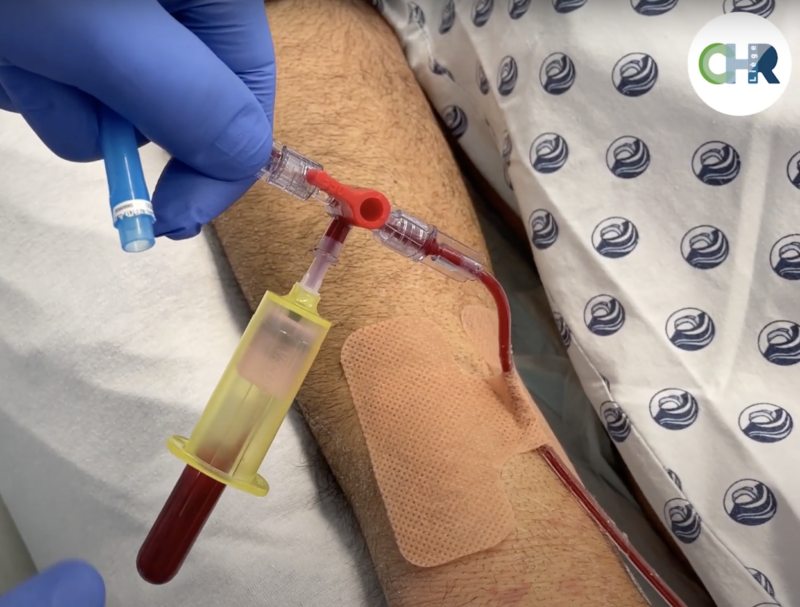Comment réaliser un prélèvement sanguin via ligne artérielle ?