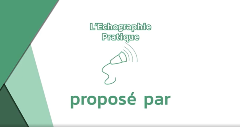 echographie